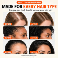 GrowTurn Hair Growth Serum