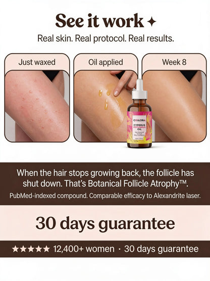 Coslora™ Cyperus Rotundus Hair Removal Oil