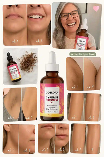 Coslora™ Cyperus Rotundus Hair Removal Oil